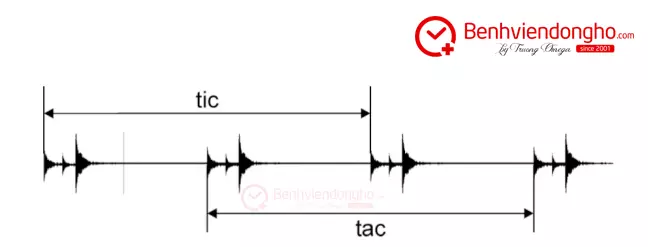 Sai lệch của đồng hồ