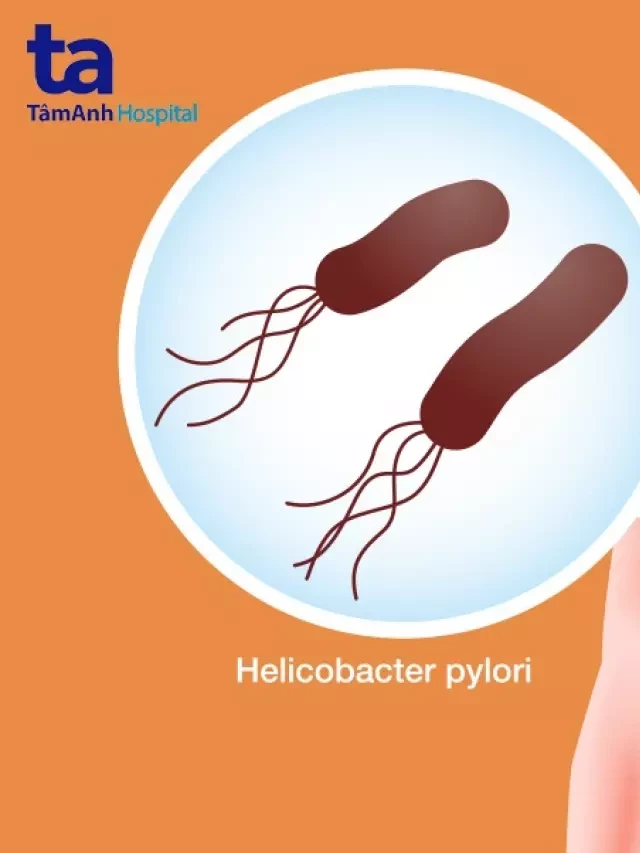   Nhiễm khuẩn H.p (Helicobacter pylori): Hiểu rõ hơn về dấu hiệu và cách điều trị