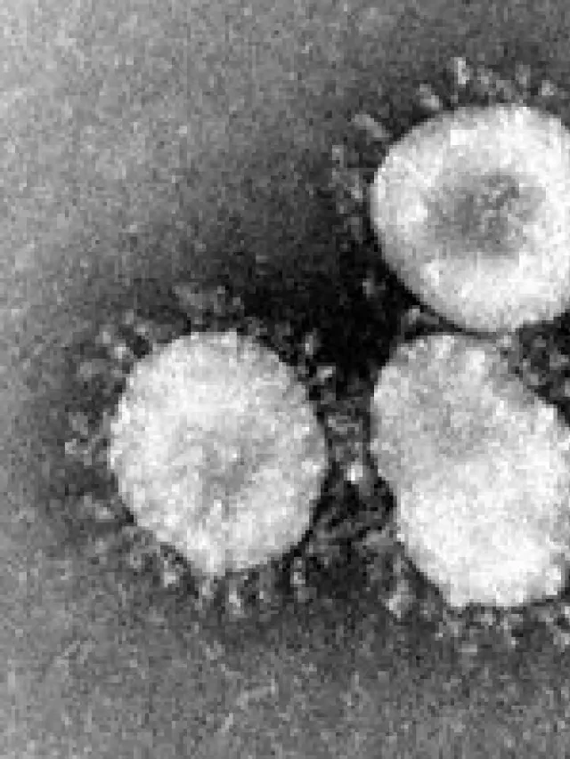   Coronavirus: Một Tổng Quan về Virus Lây Nhiễm Bùng Phát